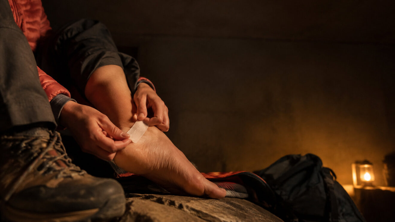 Treating a blister while hiking without making it worse